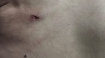 Suami Istri Asal Rajeg Korban Penganiayaan di Pandeglang